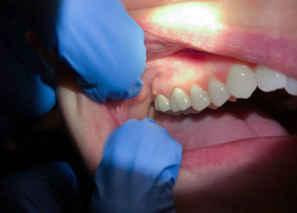 Best Dentist Open Late Near Me  in Hurstbourne Acres, KY