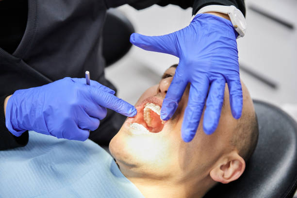 Best Chipped Tooth Repair Near Me  in Hurstbourne Acres, KY
